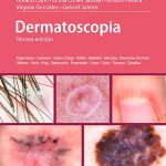 Dermatoscopia