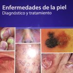 Enfermedades de la piel diagnostico y tratamiento