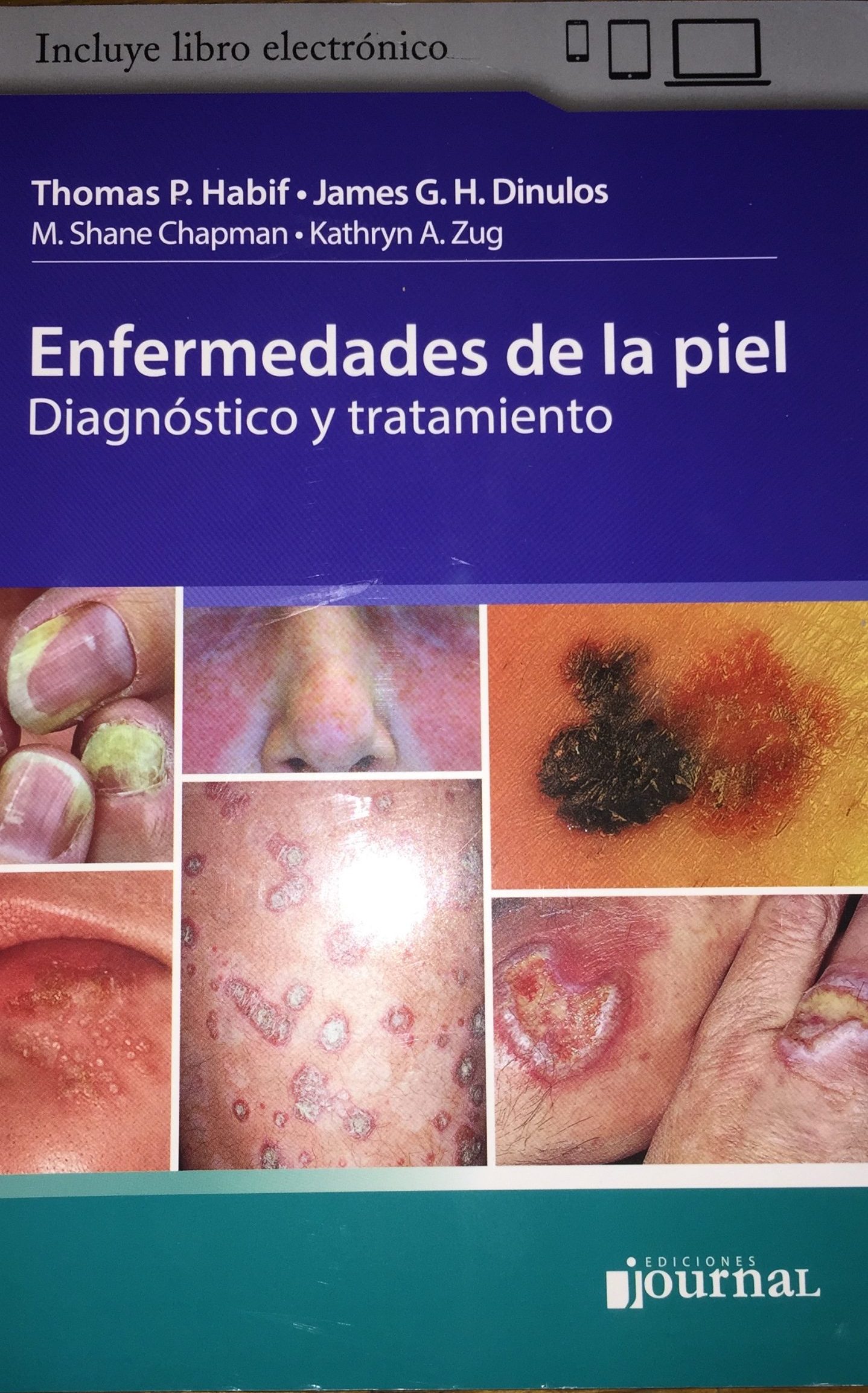 C29B1238-A16B-4ADB-A07F-793335710D17 Enfermedades de la piel diagnostico y tratamiento - Imagen 1
