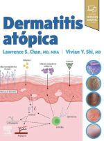 Dermatitis atopica
