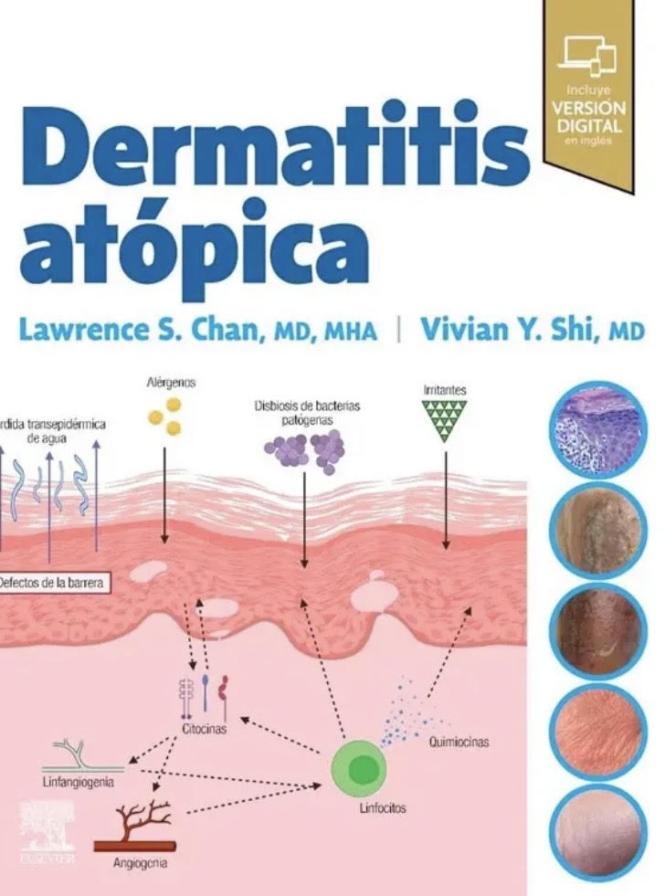Screenshot Dermatitis atopica - Imagen 1