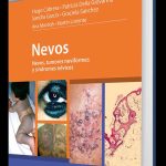 NEVOS