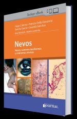 NEVOS