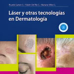 Láser y otras tecnologías en Dermatología