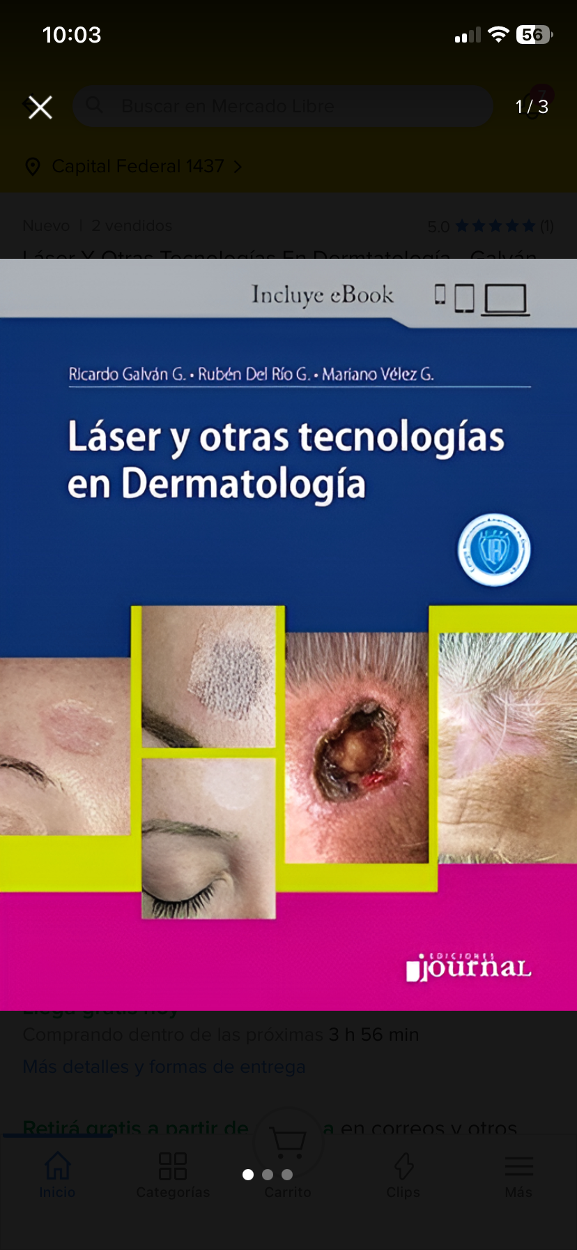 IMG_0539 Láser y otras tecnologías en Dermatología - Imagen 1